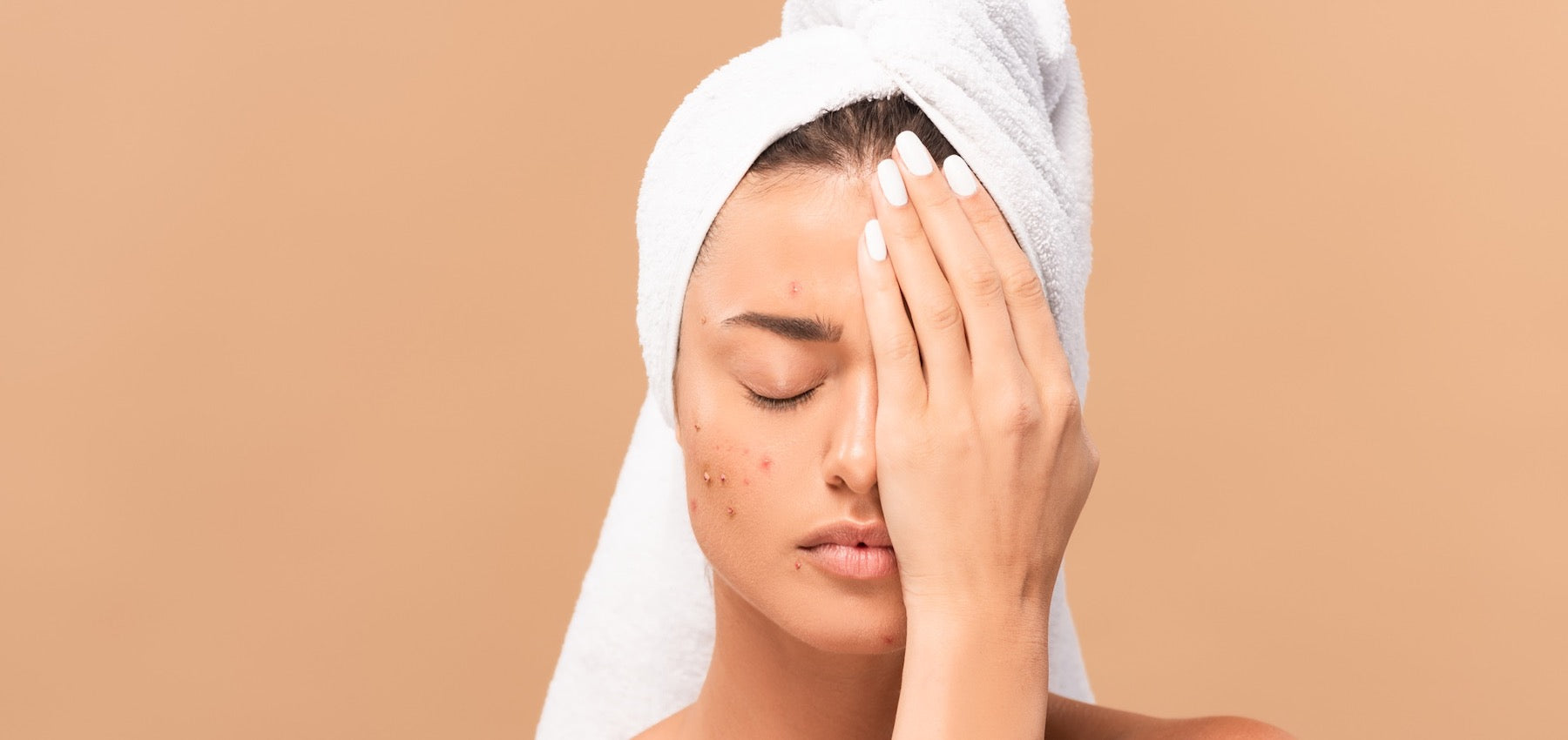 Does Using Your Body Towel on Your Face Cause Breakouts?