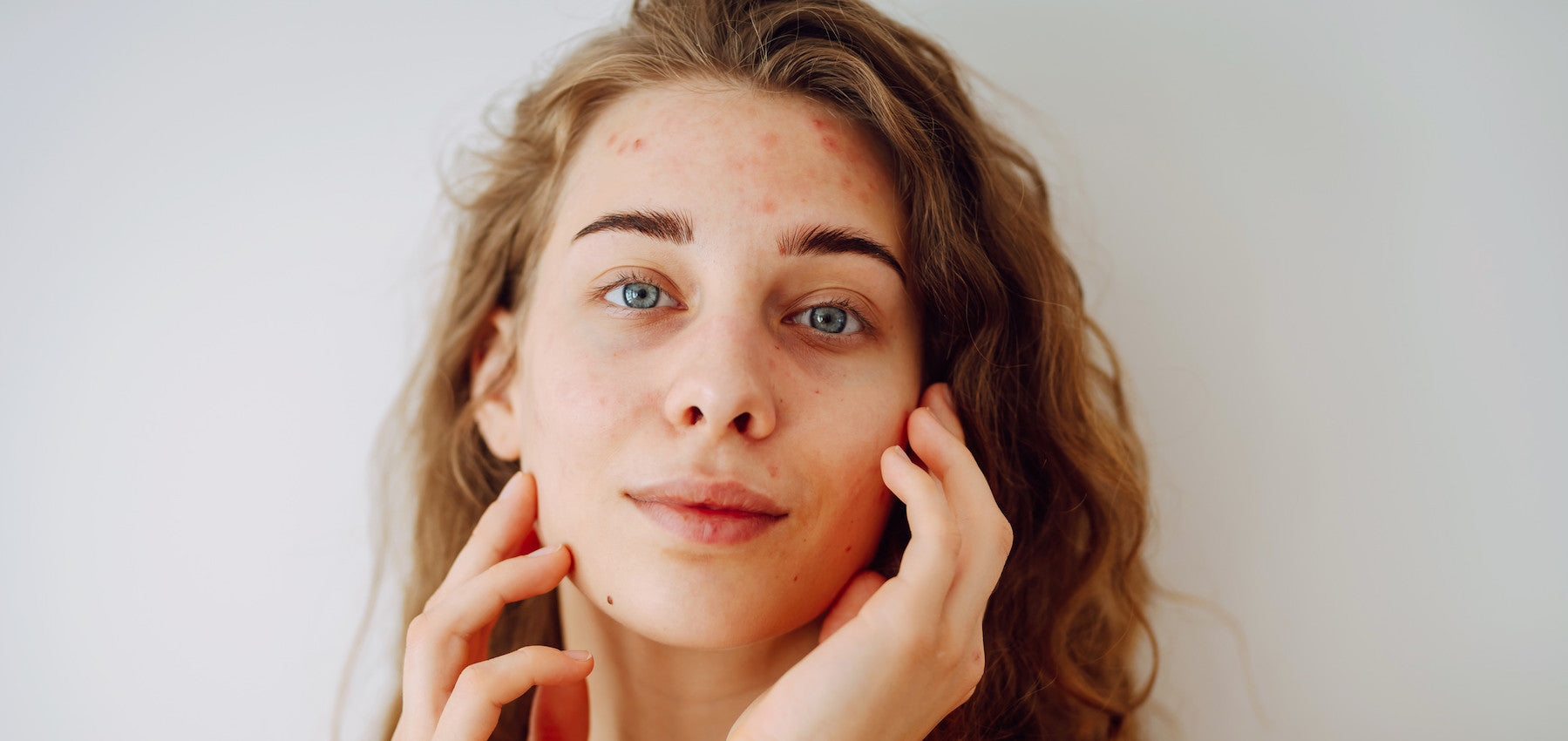 Coenzyme Q10 Serum for Face Redness: How It Helps & Ways to Add CoQ10